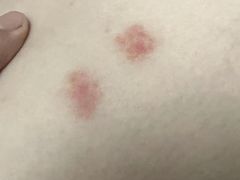 -悦和堂中医门诊部·疼痛调理·针灸推拿·艾灸拔罐