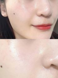 点击看大图 -SKIN79皮肤管理中心