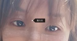 体验后-天津伊美尔医疗整形美容专科医院