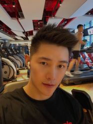 体验后-大麦微针植发全国连锁