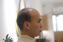 -发饰美男士增发补发假发定制店