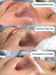 -MLP美丽派·问题肌疗愈中心