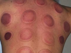 -1号足道推拿会馆