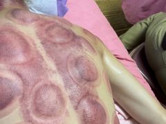 -沈师傅盲人按摩工作室(密三小区店)