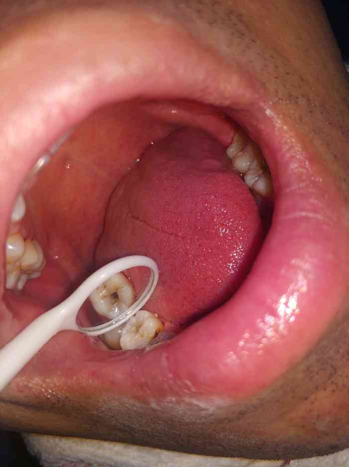 郑虹口腔-"【项目】洗牙在凯悦酒店对面二楼,好找."-大众点评移动版