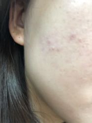 -痘院长·祛痘·皮肤管理