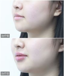 -美莱医学美容医院