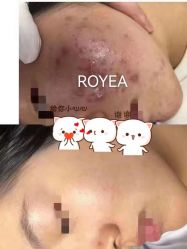 点击看大图 -ROYEA茹彦祛痘·问题肌肤修护中心
