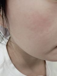 -美瑞莎创美医疗美容