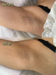 -植蔻妍倍儿专业脱毛·皮肤管理