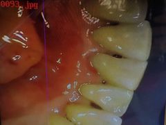 -Dr.Z dental仁康种植矫正中心