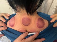 -喜艾堂艾灸馆(世贸天阶店)