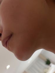 -广东韩妃整形外科医院