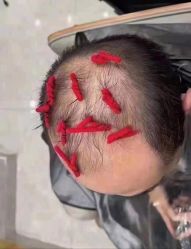-AD HAIR 