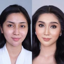 -美肤盾祛痘·问题肌头疗管理中心