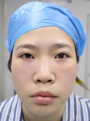 -天津健丽·去眼袋医疗美容机构