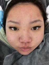 -澳尔颜选医疗美容