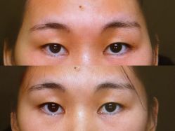 -Yestar 嘉兴艺星医疗美容医院