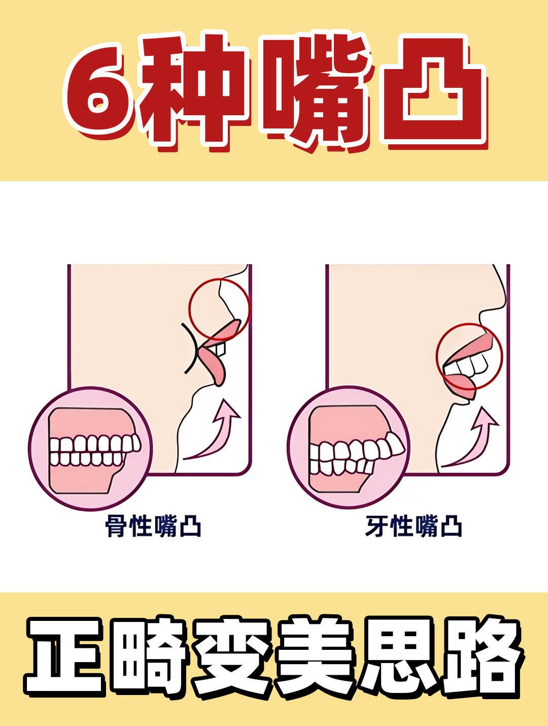 瘪嘴和正常嘴的区别图片