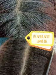 -诗碧曼养发