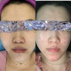 体验前-北京米扬丽格医疗美容·联合丽格鼻整形中心