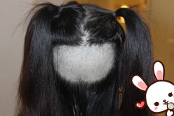 -大麦微针植发丨全国连锁