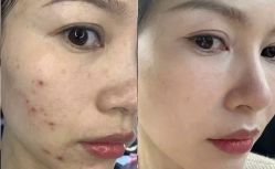 点击看大图 -SKIN79皮肤管理中心