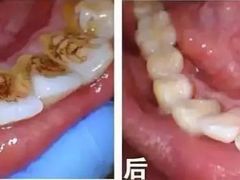 -团圆口腔·种植中心(锦江院区)