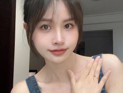 体验后-成都西区医院整形美容