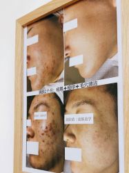 -美肤盾祛痘·问题肌头疗管理中心