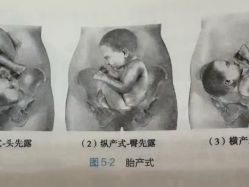 点击看大图 -昕孕瑜伽·孕妇瑜伽·产后修复