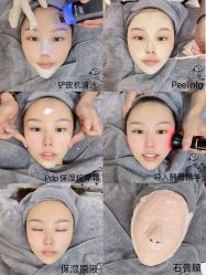 -MLP美丽派·问题肌疗愈中心