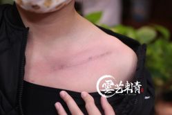 -雲艺刺青·洗纹身