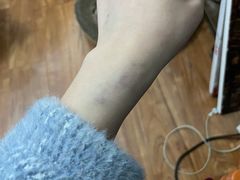-成都恒博医院·全科检查