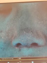 -苑苑vbeauty科技美容SPA