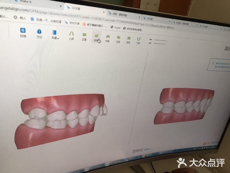 你确定你不想矫牙？