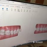 你确定你不想矫牙？