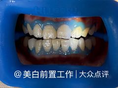 -上海仁爱医院口腔科 · 种植