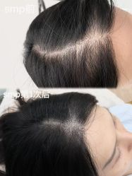 点击看大图 -西施无菌半永久纹绣眉眼影唇轻增发纹发际线