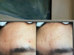-苑苑vbeauty科技美容SPA