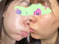 体验后-JS医疗美容