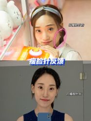 体验前-More摩尔医美の注射线雕光电中心