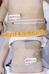 -Lily纤美·科技减脂中心