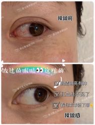 -LUNA皮相美·骨相美高级美感