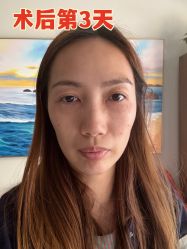 -广州健丽·去眼袋医疗美容机构