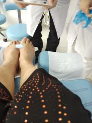 -派恩宜灰指甲鸡眼嵌甲手足癣