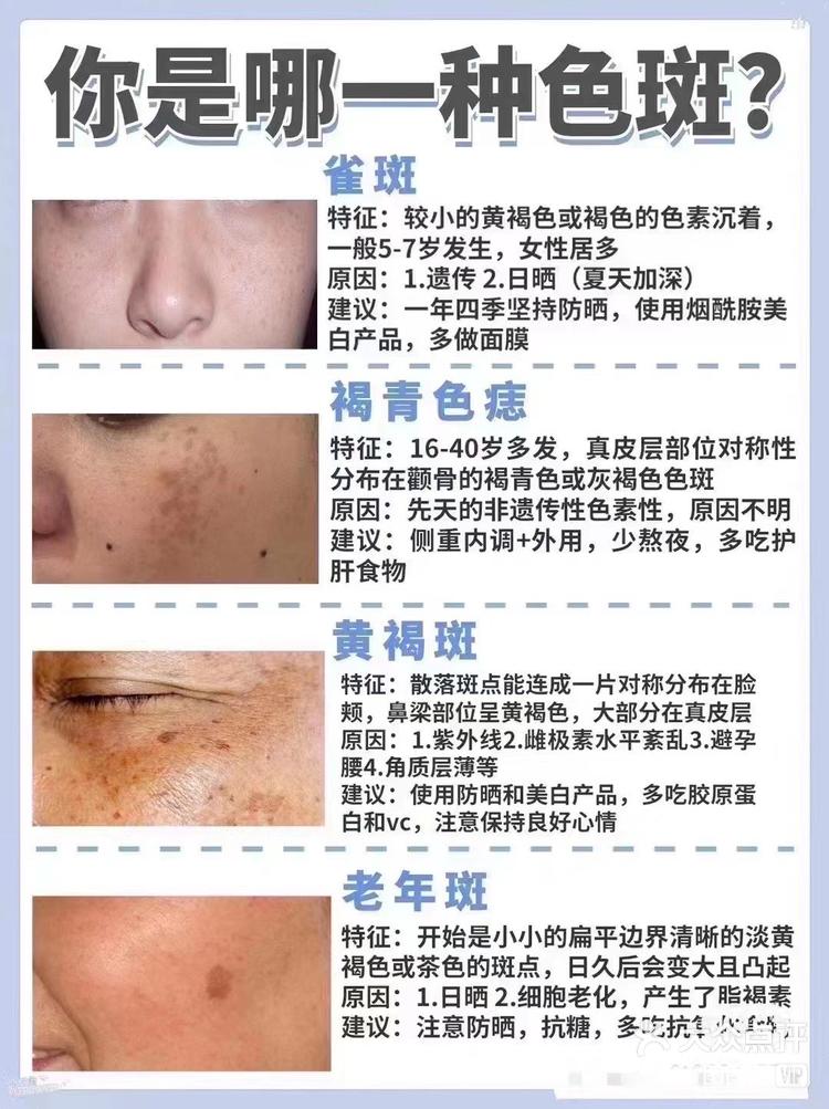 app查看高清大图 图图图 7月8日 10:18 关注 定性斑与活性斑的区别