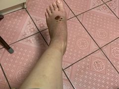 -大韩庄韩氏祖传正骨