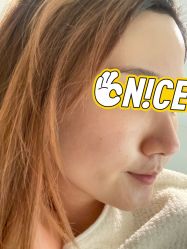 体验后-JNK皮肤管理中心