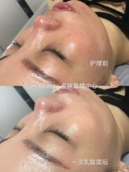 -Hi Beauty Skin 科技美肤中心